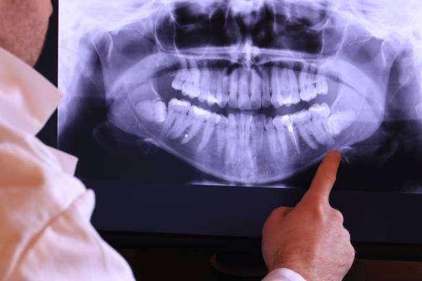 Best Emergency Gum Treatment in Wesley Chapel, FL