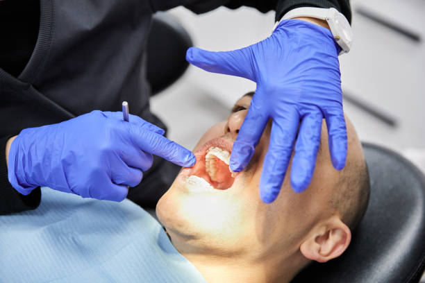 Best Emergency Root Canal Treatment in Wesley Chapel, FL
